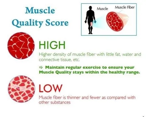 Muscle Quality Score